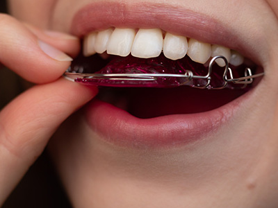 Gentle Breeze Family Dentistry | Dental Bridges, Extractions and Dental Lab
