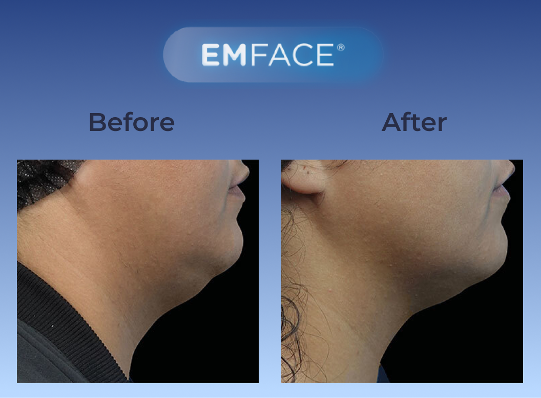 Gentle Breeze Family Dentistry | CEREC, Sedation Dentistry and Fluoride Treatment