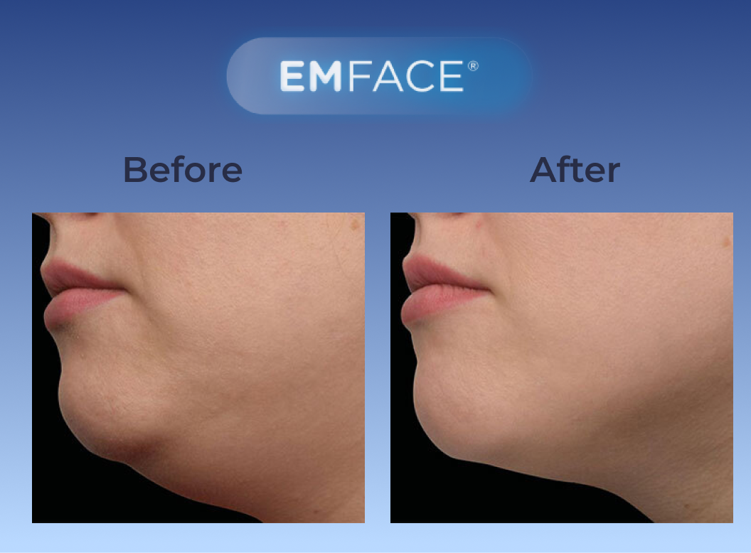 Gentle Breeze Family Dentistry | E4D, Full Mouth Reconstruction and Dental Bridges