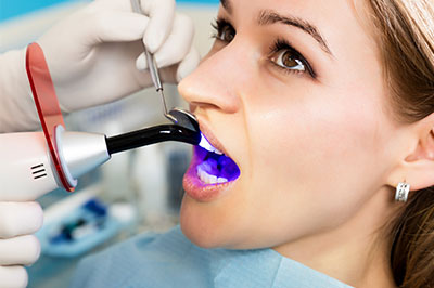 Gentle Breeze Family Dentistry | Preventative Program, Dental Sealants and Gingivitis
