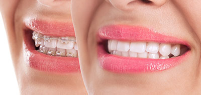 Gentle Breeze Family Dentistry | Periodontal Treatment, Intraoral Camera and Preventative Program