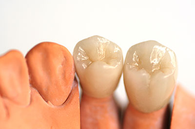 Gentle Breeze Family Dentistry | Dental Lab, Teeth Whitening and Intraoral Camera