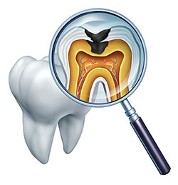 Gentle Breeze Family Dentistry | Dentures, Crown Lengthening and E4D