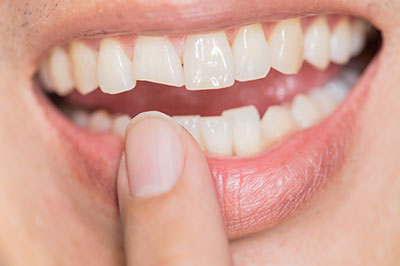 Gentle Breeze Family Dentistry | Cosmetic Dentistry, Dentures and Night Guards