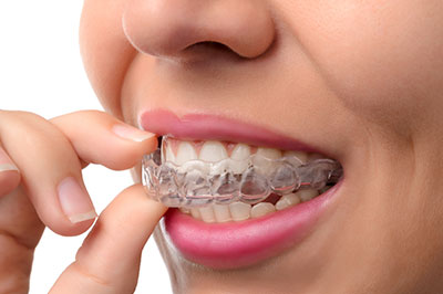 Gentle Breeze Family Dentistry | Intraoral Camera, Periodontal Treatment and CEREC