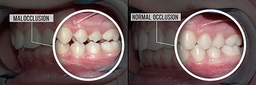 Gentle Breeze Family Dentistry | Implant Restorations, Teeth Whitening and Oral Exams