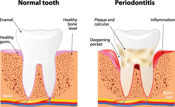 Gentle Breeze Family Dentistry | Sedation Dentistry, Veneers and Oral Exams