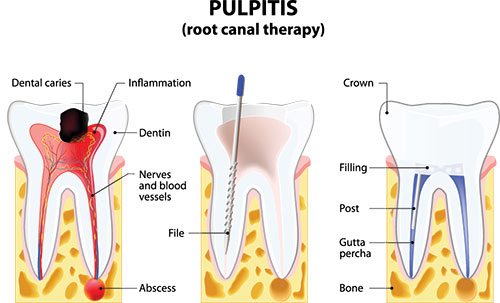 Gentle Breeze Family Dentistry | Dental Bridges, Periodontal Treatment and Cosmetic Dentistry