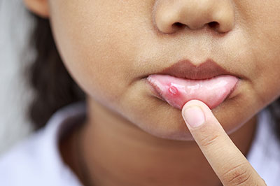 Gentle Breeze Family Dentistry | Ceramic Crowns, Cosmetic Dentistry and Emergency Treatment