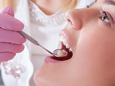 Gentle Breeze Family Dentistry | Teeth Whitening, Dental Sealants and Dental Bridges